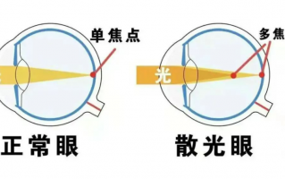 有散光没配散光会怎么样，有散光没配散光会怎么样吗